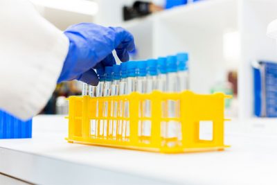 cannabis samples in test tubes to be tested for flavonoid content